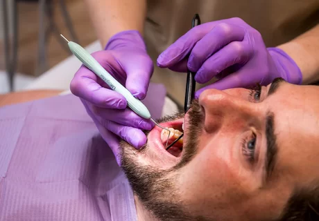 Waarom naar de mondhygiënist?